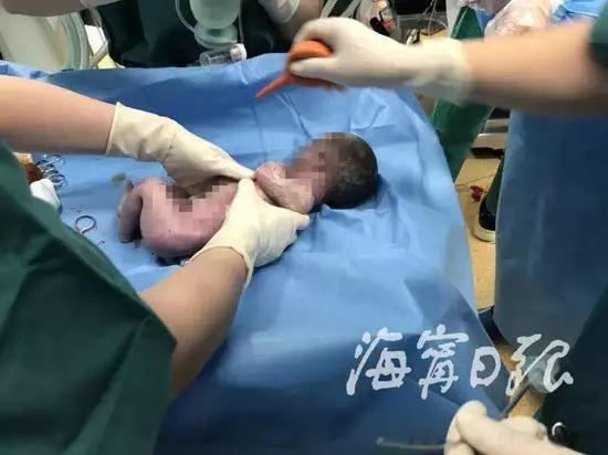 婴儿早产气息微弱 父亲放弃抢救前一句话让人泪崩