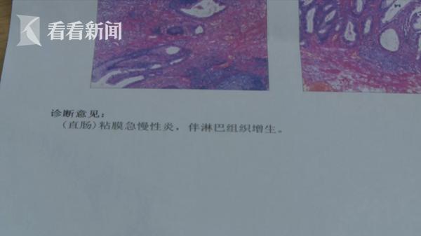 孩子常喊“屁股疼”还有血 医生：零食吃多了脱肛