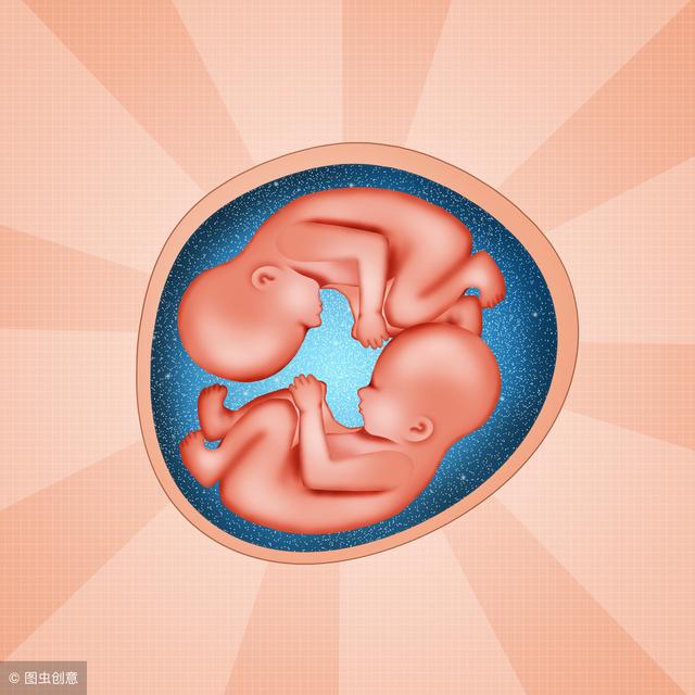 双胞胎孕妇如何选择唐筛、无创DNA、羊水穿刺？医生：这样选