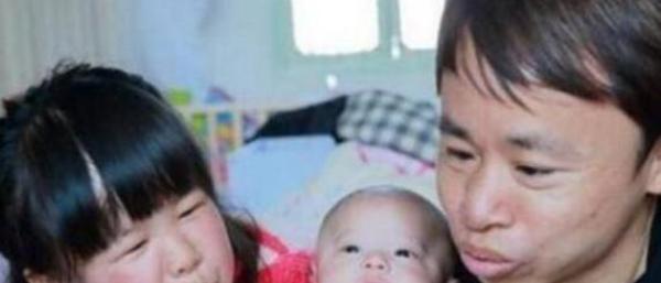 袖珍夫妻结婚后坚持生下孩子，结果娃出生后，长相让家人非常担忧