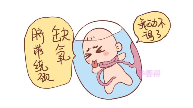 孕期的这个小动作，易造成胎儿脐带绕颈，孕妈别不放心上