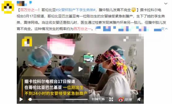 女婴“生”下没有内脏的孪生弟弟，发生率仅为百万分之一