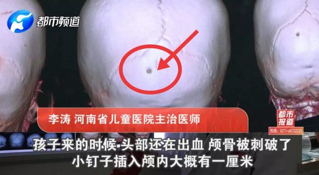 玩具成凶器！中牟1岁孩子头颅被刺穿！这些伤人玩具你家可能也有