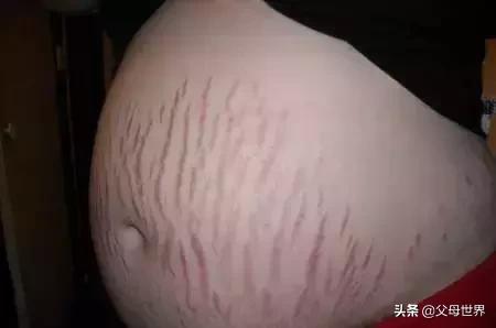 不生一次孩子，你永远不会相信这是真的！很多妈妈深有感触，扎心