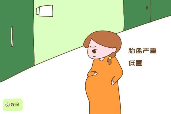 孕期多走路生得快？孕妈先别盲从，这几种孕妇适合“懒着”
