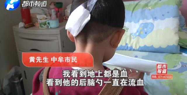 玩具成凶器！中牟1岁孩子头颅被刺穿！这些伤人玩具你家可能也有