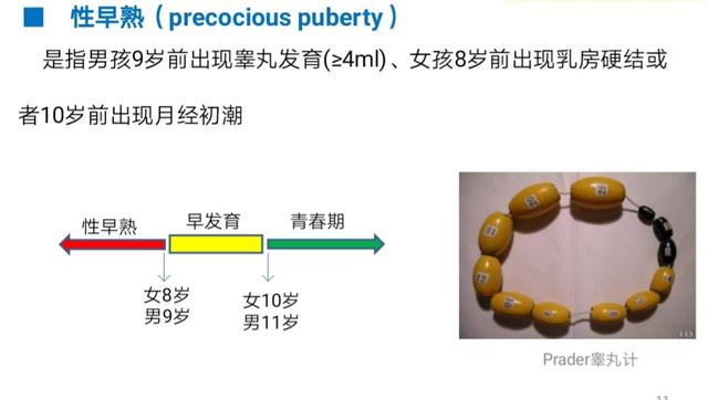 儿童真性性早熟VS假性性早熟，哪种更严重？