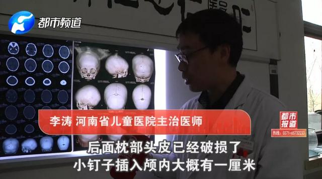 玩具成凶器！中牟1岁孩子头颅被刺穿！这些伤人玩具你家可能也有