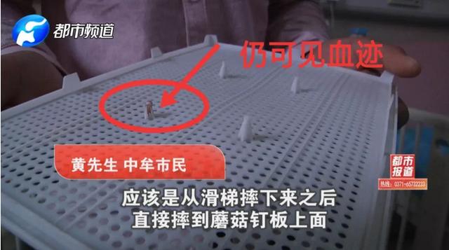 玩具成凶器！中牟1岁孩子头颅被刺穿！这些伤人玩具你家可能也有