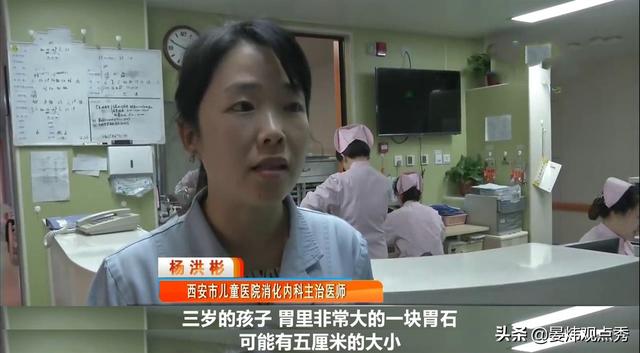 3岁男童贫血、黑便，胃里长出“大石块