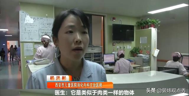 3岁男童贫血、黑便，胃里长出“大石块