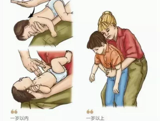 宝宝在家发生误吞异物，家长应该怎么处理呢？
