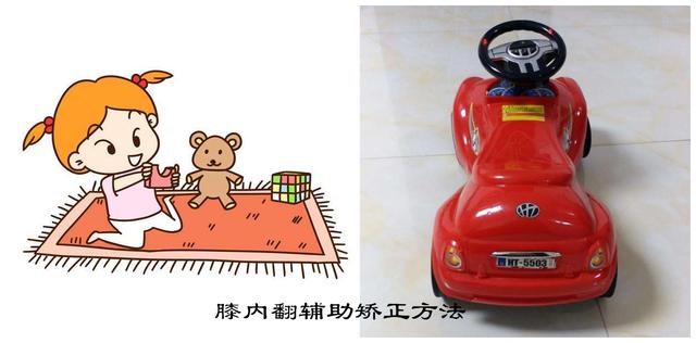 膝内、外翻在运动、坐姿方面分别要注意什么？