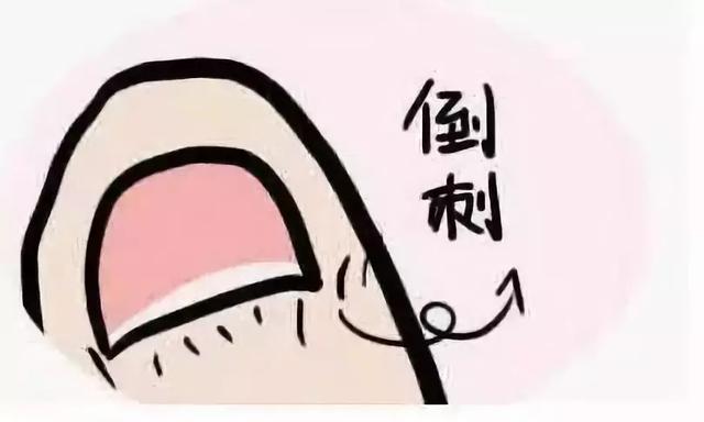 宝宝长倒刺是缺维生素？其实这样做才是关键