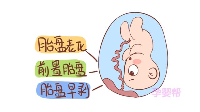 孕期出现这几种情况，易引起胎盘早剥，准妈妈别不在意