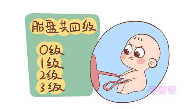 孕期出现这几种情况，易引起胎盘早剥，准妈妈别不在意