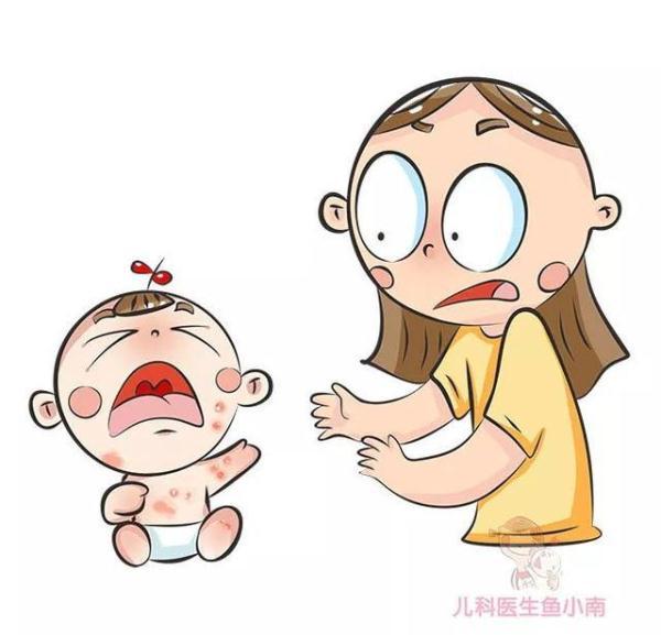 宝宝皮肤问题总反复，医生：首先你必须要分清皮疹湿疹热疹这3种