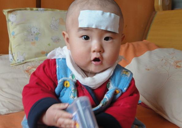 孩子积食反复还顽固，一个“消食良方”很常见，妈妈却经常忽视