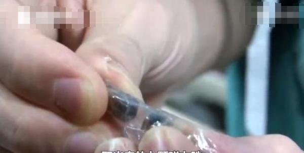 妈妈网购磁力珠玩具 3岁宝宝误吞7颗致胃肠12处穿孔