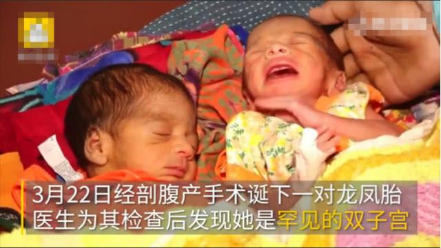 女子生完儿子26天后觉得肚子痛，送到医院发现还怀着一对龙凤胎