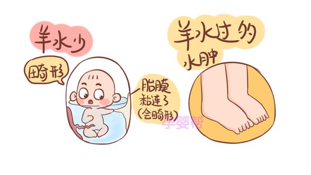 孕期有这3个习惯，可能会让羊水质量变差，你有吗？