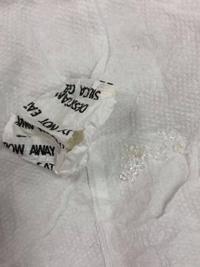儿科急诊小故事：医生啊，我儿子吞了干燥剂