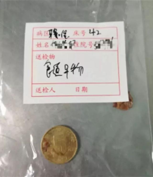 热点丨1岁娃连吐四五天，最后竟要全麻手术！只因爸爸忽视了一句话…
