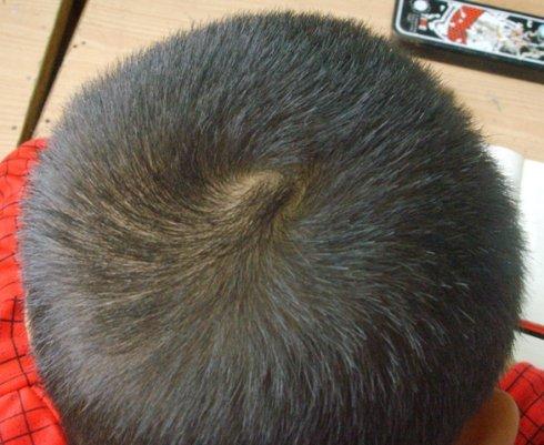 孩子头上的漩，原来影藏了这么多秘密！家长快看看你家孩子有几个