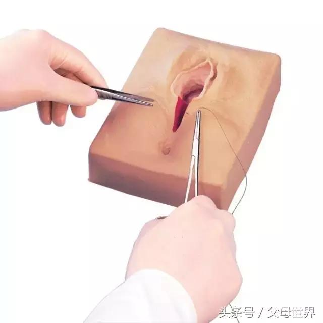 撕裂还是侧切？不想顺产时遇到，掌握这个小技能，赶紧动起来吧！