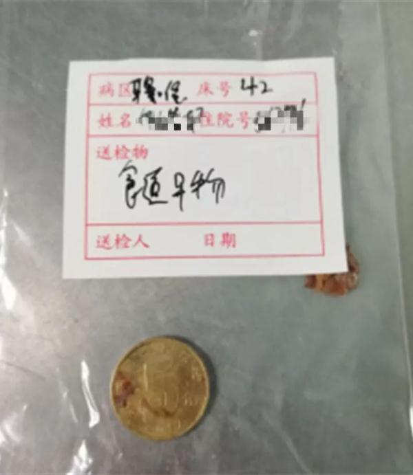 1岁娃误吞硬币连吐五天,最后竟要全麻手术!粗心奶爸却未发现