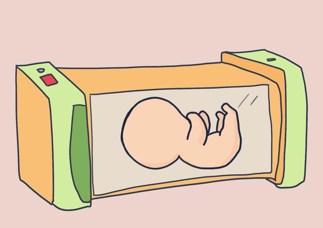 十宝遇八“黄”，新生儿黄疸的成因和预防，孕妈得知晓！