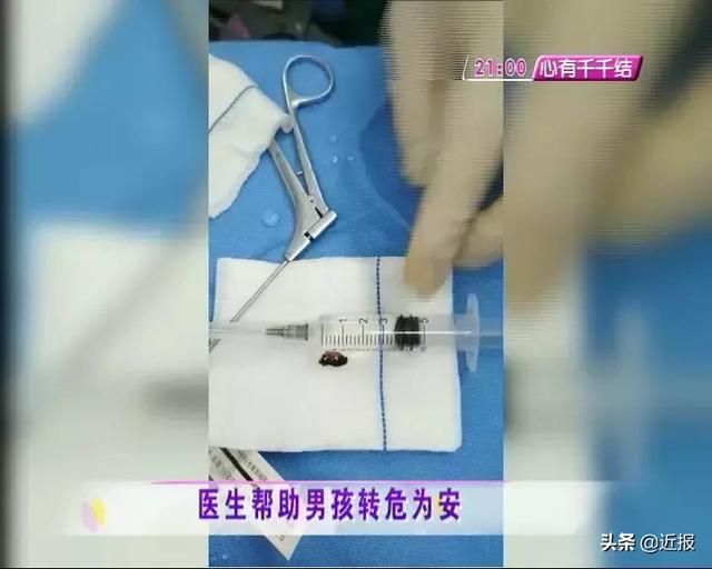 济南一2岁男孩咳嗽不止，最后竟要全麻手术，只因家长没看住……