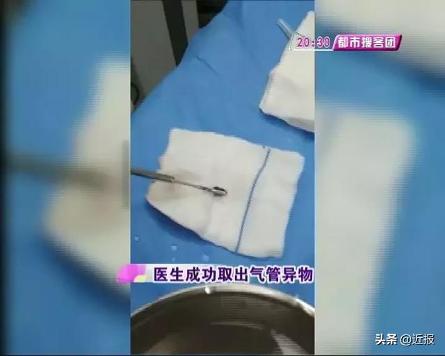 济南一2岁男孩咳嗽不止，最后竟要全麻手术，只因家长没看住……