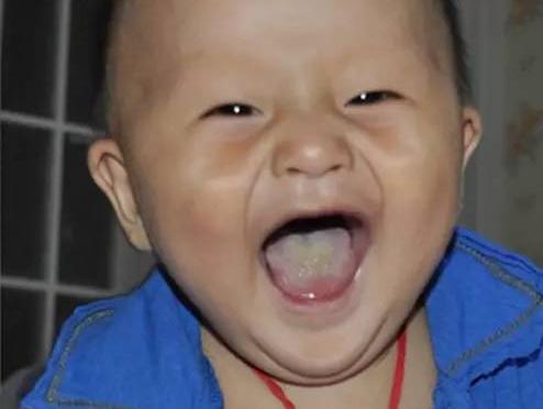 孩子脾胃好不好，“看脸”就知道！谨记这4点，养好脾胃、长个子