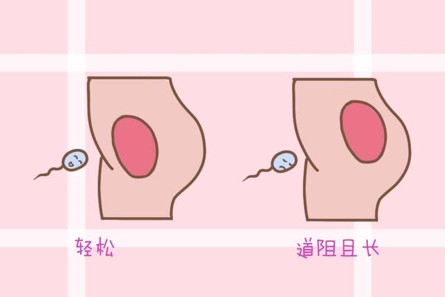 子宫位置决定了女性怀孕的难易程度，若存在这些情况，是难孕体质