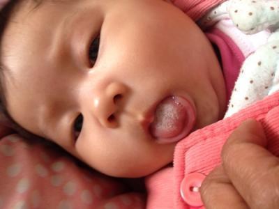 娃就怕内火重，爱积食，医生劝告：清明过后，3招调理，娃少生病