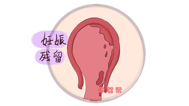 产后恶露什么时间排尽最好？产科医生：不得晚于这个时间，很危险