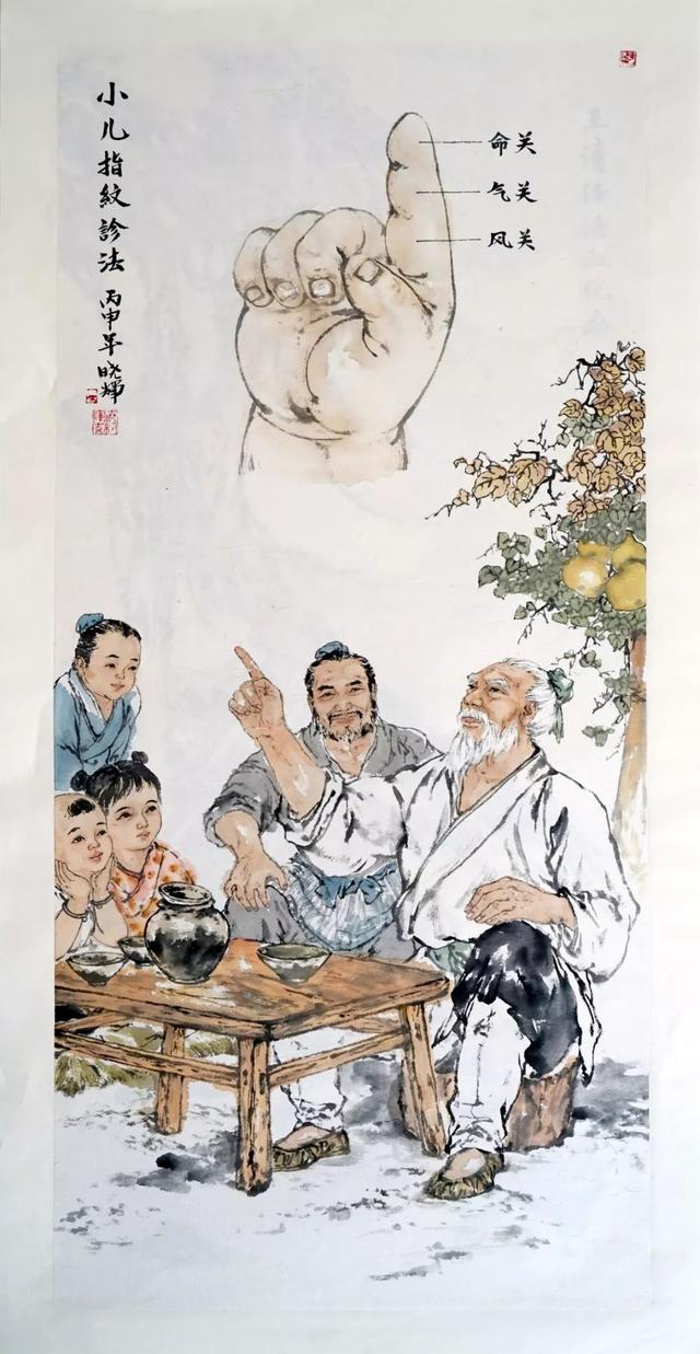 看看宝宝食指指纹，就知道什么病？这么神奇吗？