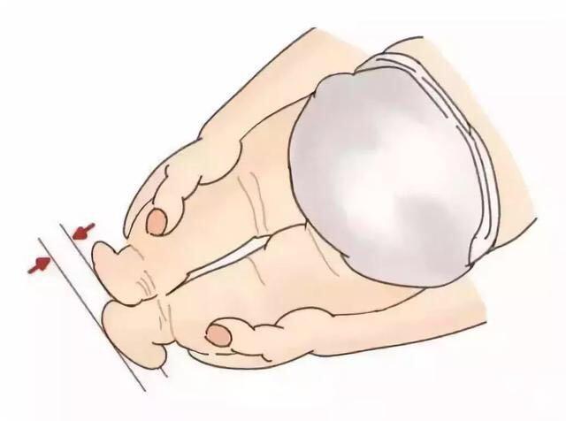 6岁孩子跛行严重，原来父母忽视了这点