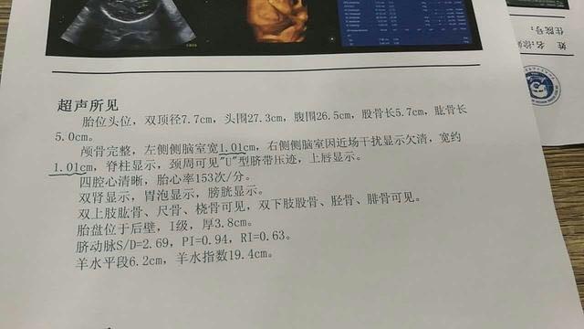 孕期侧脑室增宽就是异常？孕妈了解后更放心了