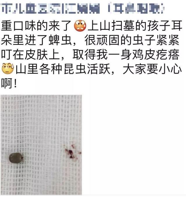扫墓回来，4岁男孩突然耳痛！手电筒一照，家长吓坏了
