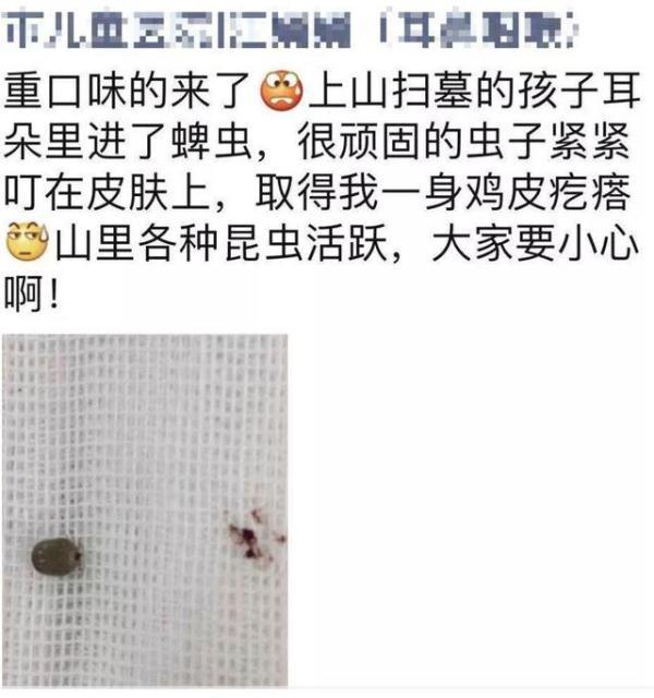 扫墓回来，4岁男孩突然耳孔痛！手电筒一照，家长魂都吓飞……这东西要命啊！