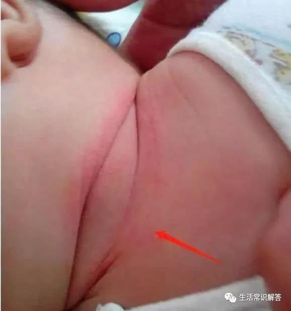 2个月宝宝身体发臭，送去医院检查，结果出来后，全家瞬间不淡定