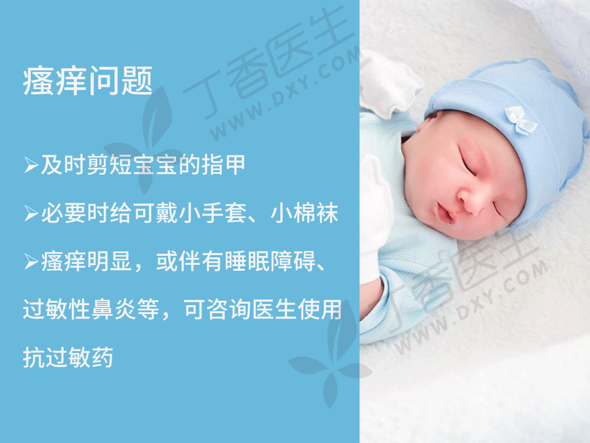婴儿湿疹老是反反复复怎么办？九条建议帮助你
