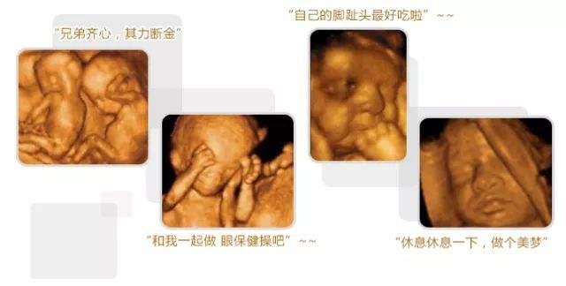 做四维彩超，看到胎儿在吸吮手指，说明宝宝发育好，还很聪明