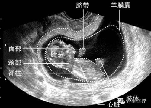 孕期6次超声检查准确时间表！建议宝妈收藏！