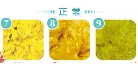 宝宝粪便呈以下6种状态颜色，新手妈妈应该引起足够的重视！