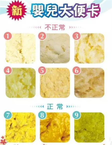 宝宝粪便呈以下6种状态颜色，新手妈妈应该引起足够的重视！