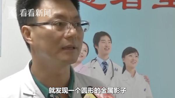 1岁男童接连呕吐多日 X光片显示竟有一圆形阴影