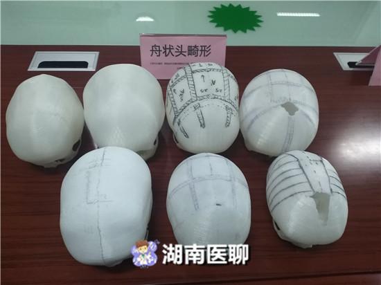 1岁宝宝头颅天生畸形却找不出病因，孩子头颅外观异常怎么办？